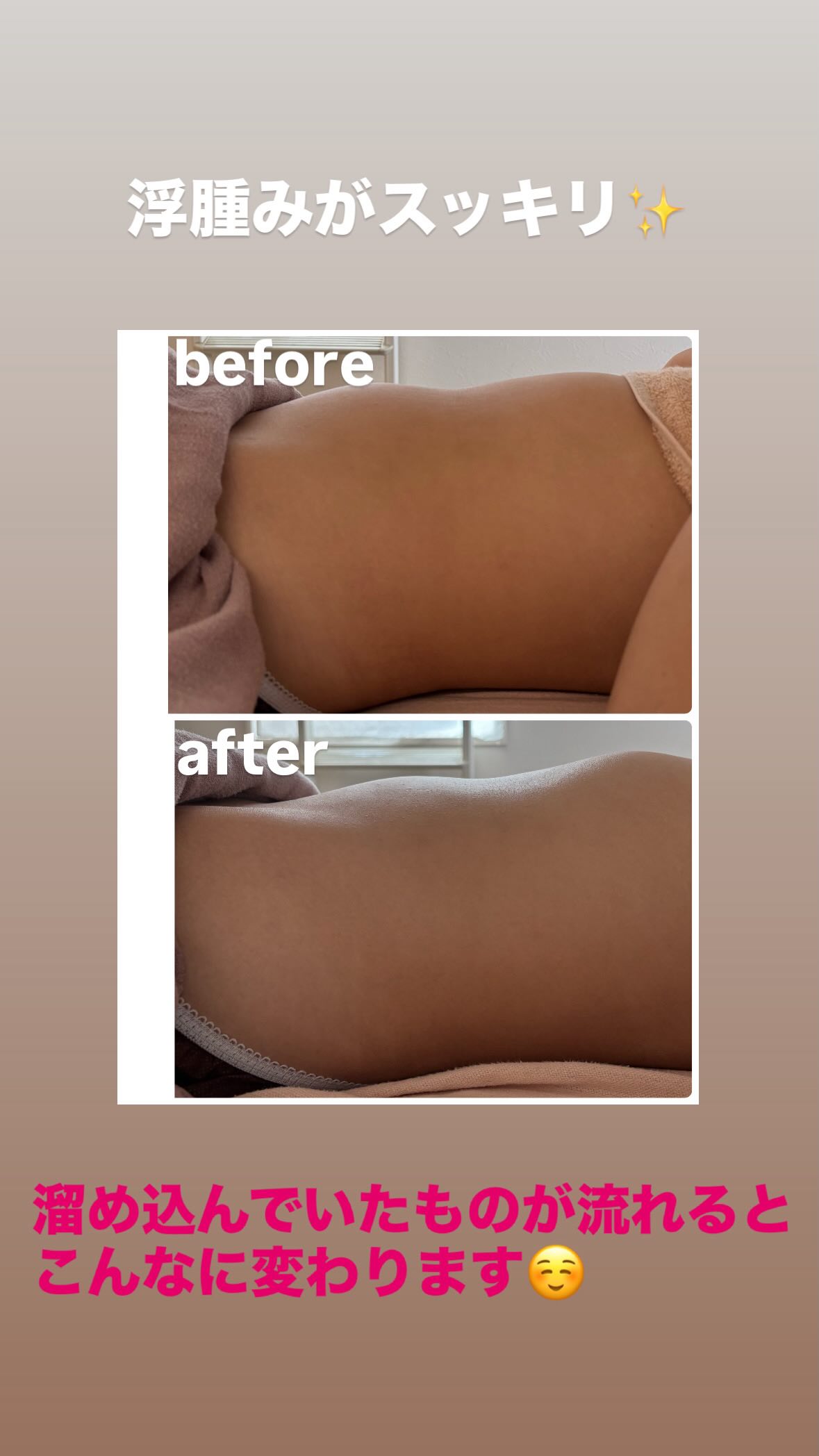 浮腫みスッキリ Before/After